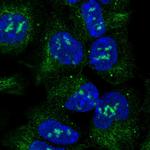 ACVR1 Antibody in Immunocytochemistry (ICC/IF)