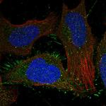 CALCRL Antibody in Immunocytochemistry (ICC/IF)