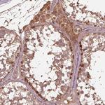 METTL4 Antibody in Immunohistochemistry (Paraffin) (IHC (P))