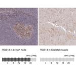 RGS14 Antibody in Immunohistochemistry (Paraffin) (IHC (P))