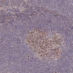 RGS14 Antibody in Immunohistochemistry (Paraffin) (IHC (P))