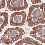 FUT3 Antibody in Immunohistochemistry (Paraffin) (IHC (P))