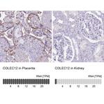 COLEC12 Antibody in Immunohistochemistry (Paraffin) (IHC (P))