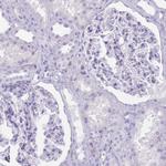 COLEC12 Antibody in Immunohistochemistry (Paraffin) (IHC (P))