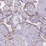 COLEC12 Antibody in Immunohistochemistry (Paraffin) (IHC (P))