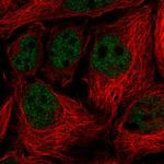 Vinexin Antibody in Immunocytochemistry (ICC/IF)