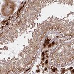 GNS Antibody in Immunohistochemistry (Paraffin) (IHC (P))