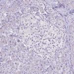 CYP17A1 Antibody in Immunohistochemistry (Paraffin) (IHC (P))