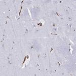 EML1 Antibody in Immunohistochemistry (Paraffin) (IHC (P))