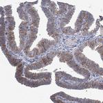 K-Ras Antibody in Immunohistochemistry (Paraffin) (IHC (P))