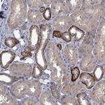 K-Ras Antibody in Immunohistochemistry (Paraffin) (IHC (P))