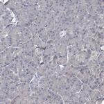 K-Ras Antibody in Immunohistochemistry (Paraffin) (IHC (P))