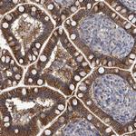 K-Ras Antibody in Immunohistochemistry (Paraffin) (IHC (P))