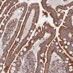 MAVS Antibody in Immunohistochemistry (Paraffin) (IHC (P))