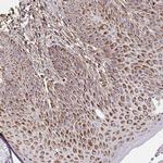 MAVS Antibody in Immunohistochemistry (Paraffin) (IHC (P))