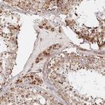 MAVS Antibody in Immunohistochemistry (Paraffin) (IHC (P))