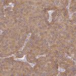 PLA2G4A Antibody in Immunohistochemistry (Paraffin) (IHC (P))