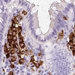 HLA-DRA Antibody in Immunohistochemistry (Paraffin) (IHC (P))