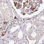 HLA-DRA Antibody in Immunohistochemistry (Paraffin) (IHC (P))