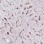 HLA-DRA Antibody in Immunohistochemistry (Paraffin) (IHC (P))