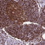 HLA-DRA Antibody in Immunohistochemistry (Paraffin) (IHC (P))