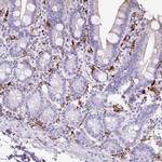 HLA-DRA Antibody in Immunohistochemistry (Paraffin) (IHC (P))