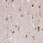 ATP13A2 Antibody in Immunohistochemistry (Paraffin) (IHC (P))