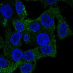 Coronin 1A Antibody in Immunocytochemistry (ICC/IF)