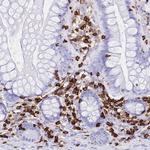 Coronin 1A Antibody in Immunohistochemistry (Paraffin) (IHC (P))