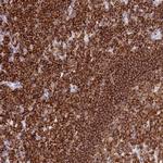 Coronin 1A Antibody in Immunohistochemistry (Paraffin) (IHC (P))