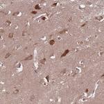 GABRB1 Antibody in Immunohistochemistry (Paraffin) (IHC (P))