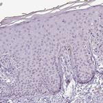 Apolipoprotein C1 Antibody in Immunohistochemistry (Paraffin) (IHC (P))