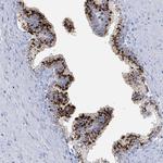 Kallikrein 4 Antibody in Immunohistochemistry (Paraffin) (IHC (P))