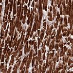 CKMT2 Antibody in Immunohistochemistry (Paraffin) (IHC (P))