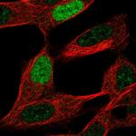 IA-6 Antibody in Immunocytochemistry (ICC/IF)