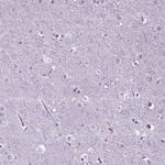 CD10 Antibody in Immunohistochemistry (Paraffin) (IHC (P))