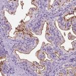 CD10 Antibody in Immunohistochemistry (Paraffin) (IHC (P))