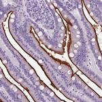 CD10 Antibody in Immunohistochemistry (Paraffin) (IHC (P))