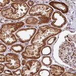 SARS2 Antibody in Immunohistochemistry (Paraffin) (IHC (P))