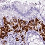 HLA-DRA Antibody in Immunohistochemistry (Paraffin) (IHC (P))