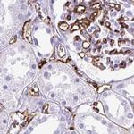 HLA-DRA Antibody in Immunohistochemistry (Paraffin) (IHC (P))