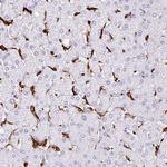 HLA-DRA Antibody in Immunohistochemistry (Paraffin) (IHC (P))