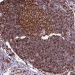 HLA-DRA Antibody in Immunohistochemistry (Paraffin) (IHC (P))