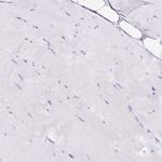 HLA-DRA Antibody in Immunohistochemistry (Paraffin) (IHC (P))