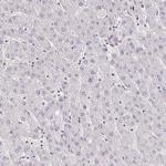 HBEGF Antibody in Immunohistochemistry (Paraffin) (IHC (P))