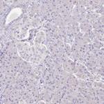 HBEGF Antibody in Immunohistochemistry (Paraffin) (IHC (P))