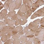 HBEGF Antibody in Immunohistochemistry (Paraffin) (IHC (P))