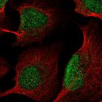 KDM5B Antibody in Immunocytochemistry (ICC/IF)