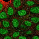 SEMA4A Antibody in Immunocytochemistry (ICC/IF)