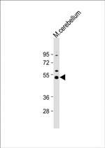 Dnmt2 Antibody in Western Blot (WB)